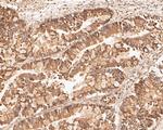 LSS Antibody in Immunohistochemistry (Paraffin) (IHC (P))