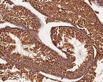 BRCA1 Antibody in Immunohistochemistry (Paraffin) (IHC (P))