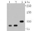 BRCA1 Antibody in Western Blot (WB)