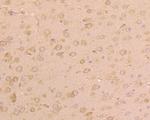 UGGT1 Antibody in Immunohistochemistry (Paraffin) (IHC (P))