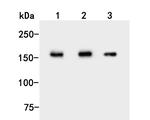UGGT1 Antibody in Western Blot (WB)
