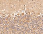 p50 dynamitin Antibody in Immunohistochemistry (Paraffin) (IHC (P))