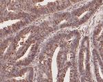 CCL2/MCP1 Antibody in Immunohistochemistry (Paraffin) (IHC (P))