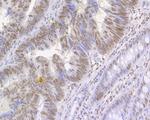 Histone H3 (acetyl K27) Antibody in Immunohistochemistry (Paraffin) (IHC (P))