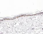 Histone H3 (acetyl K27) Antibody in Immunohistochemistry (Paraffin) (IHC (P))