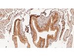 CREBBP Antibody in Immunohistochemistry (Paraffin) (IHC (P))