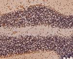CREBBP Antibody in Immunohistochemistry (Paraffin) (IHC (P))