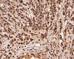 CREBBP Antibody in Immunohistochemistry (Paraffin) (IHC (P))