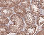 AKT2 Antibody in Immunohistochemistry (Paraffin) (IHC (P))