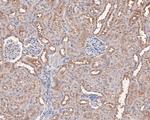 AKT2 Antibody in Immunohistochemistry (Paraffin) (IHC (P))