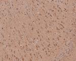 AKT2 Antibody in Immunohistochemistry (Paraffin) (IHC (P))