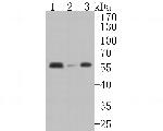 AKT2 Antibody in Western Blot (WB)