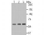 AKT2 Antibody in Western Blot (WB)