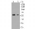 GPR161 Antibody in Western Blot (WB)