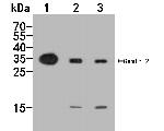 Gemin 2 Antibody in Western Blot (WB)