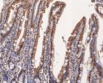 hnRNP L Antibody in Immunohistochemistry (Paraffin) (IHC (P))