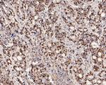 hnRNP L Antibody in Immunohistochemistry (Paraffin) (IHC (P))