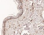 hnRNP L Antibody in Immunohistochemistry (Paraffin) (IHC (P))