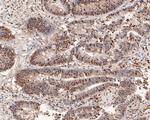 hnRNP L Antibody in Immunohistochemistry (Paraffin) (IHC (P))
