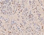 hnRNP L Antibody in Immunohistochemistry (Paraffin) (IHC (P))