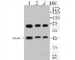hnRNP L Antibody in Western Blot (WB)