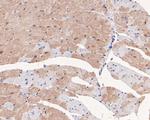 mTOR Antibody in Immunohistochemistry (Paraffin) (IHC (P))