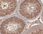 mTOR Antibody in Immunohistochemistry (Paraffin) (IHC (P))