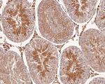 LKB1 Antibody in Immunohistochemistry (Paraffin) (IHC (P))
