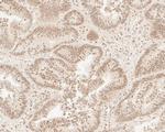 HNRPDL Antibody in Immunohistochemistry (Paraffin) (IHC (P))