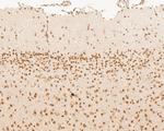 HNRPDL Antibody in Immunohistochemistry (Paraffin) (IHC (P))