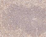 FLI1 Antibody in Immunohistochemistry (Paraffin) (IHC (P))