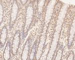 FLI1 Antibody in Immunohistochemistry (Paraffin) (IHC (P))