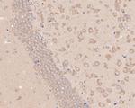 GNB3 Antibody in Immunohistochemistry (Paraffin) (IHC (P))