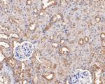 GNB3 Antibody in Immunohistochemistry (Paraffin) (IHC (P))