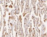Flightless 1 Antibody in Immunohistochemistry (Paraffin) (IHC (P))