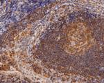 Flightless 1 Antibody in Immunohistochemistry (Paraffin) (IHC (P))