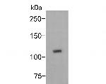EVI1 Antibody in Western Blot (WB)