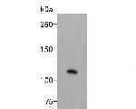EVI1 Antibody in Western Blot (WB)