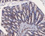ATR Antibody in Immunohistochemistry (Paraffin) (IHC (P))