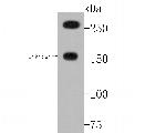 ATR Antibody in Western Blot (WB)