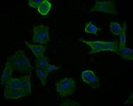 LIM Kinase 1 Antibody in Immunocytochemistry (ICC/IF)