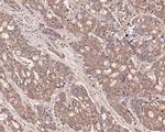 LIM Kinase 1 Antibody in Immunohistochemistry (Paraffin) (IHC (P))