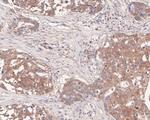 LIM Kinase 1 Antibody in Immunohistochemistry (Paraffin) (IHC (P))