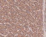 LIM Kinase 1 Antibody in Immunohistochemistry (Paraffin) (IHC (P))