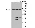 LIM Kinase 1 Antibody in Western Blot (WB)