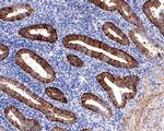 Monocarboxylic acid transporter 1 Antibody in Immunohistochemistry (Paraffin) (IHC (P))