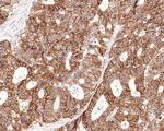 Monocarboxylic acid transporter 1 Antibody in Immunohistochemistry (Paraffin) (IHC (P))