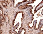 Monocarboxylic acid transporter 1 Antibody in Immunohistochemistry (Paraffin) (IHC (P))