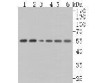 Monocarboxylic acid transporter 1 Antibody in Western Blot (WB)