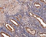 CREBBP Antibody in Immunohistochemistry (Paraffin) (IHC (P))